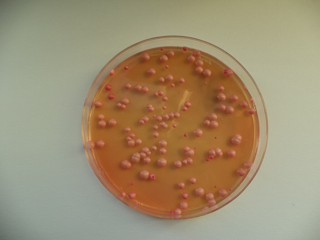 Brettanomyces plate 09